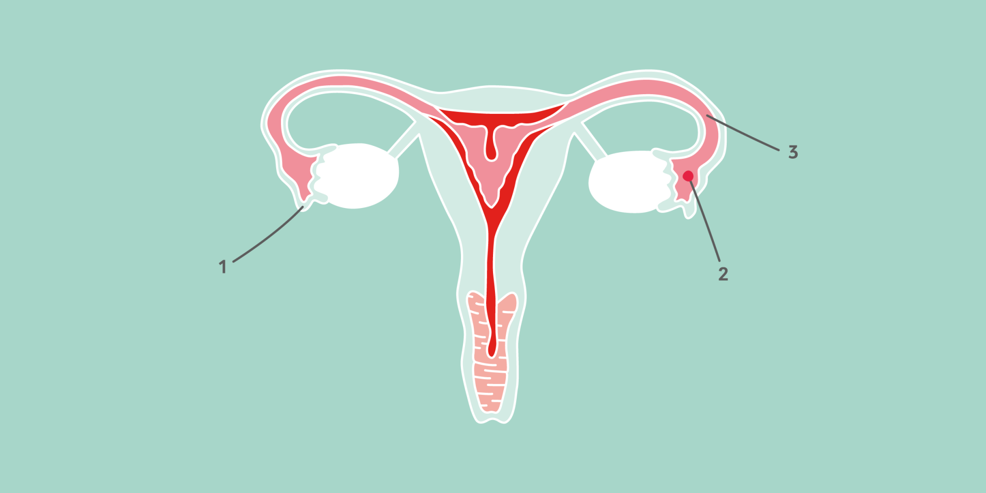 Ovulating uterus diagram